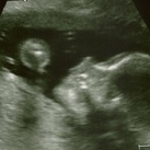 Mooierd! Eindelijk. Tijdens de 3e SEO echo lag de kleine goed. Alles is goed; hij groeit goed, hij drinkt goed, heeft voldoende vruchtwater en alles functioneert naar behoren. We zijn zo blij!