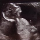 Ons hummeltje  Hier dacht ik 10 weken zwanger te zijn maar bleek al 15+4 weken te zijn! Een hele verrassing maar wat een geweldig moment