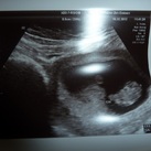 9wk en 1 dg 