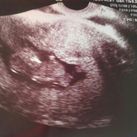  10wk+6dagen