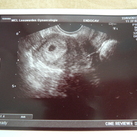 5 weken zwanger We kwamen erachter dat we echt zwanger waren!
