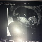  12 weken zwanger! my angel! 