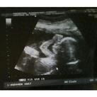 21 weken, 3 dagen echo foto gemaakt met 21 weken, 3 dagen zwangerschap