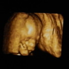 20 weken zwanger Ons zoontje met zijn handje op zijn wang =)