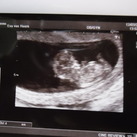 10w5d 