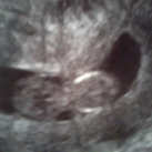 week12 
