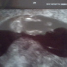 week12 