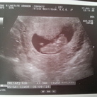  11 weken zwanger