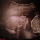 alessa hailie <3 alessa hailie <3